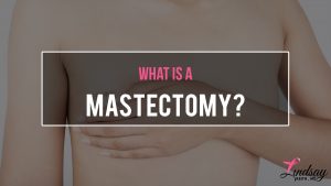 What is a Mastectomy?
