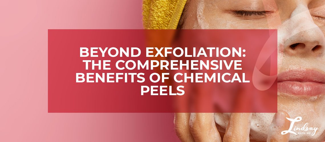 Beyond Exfoliation: The Comprehensive Benefits of Chemical Peels