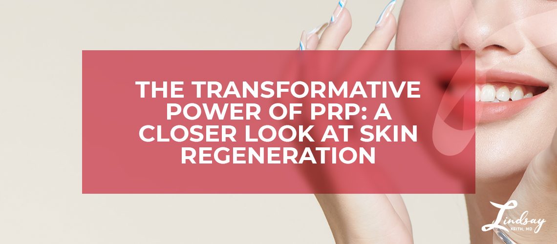The Transformative Power of PRP: A Closer Look at Skin Regeneration